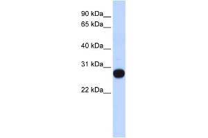 WB Suggested Anti-TCEAL4 Antibody Titration:  0. (TCEAL4 anticorps  (Middle Region))