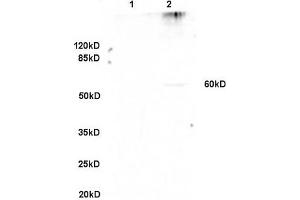 Formalin-fixed and paraffin embedded rat lung labeled with Anti-GPNMB/Osteoactivin Polyclonal Antibody, Unconjugated (ABIN749093) at 1:200 followed by conjugation to the secondary antibody and DAB staining. (Osteoactivin anticorps  (AA 81-180))
