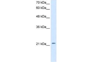 Western Blotting (WB) image for anti-Dickkopf Homolog 1 (DKK1) antibody (ABIN2463124) (DKK1 anticorps)