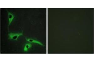 Immunofluorescence analysis of HeLa cells, using TSPAN8 Antibody. (Tspan-8 anticorps  (AA 96-145))