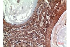 Immunohistochemistry (IHC) analysis of paraffin-embedded Human Skin, antibody was diluted at 1:100. (INHBB anticorps  (C-Term))