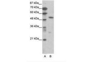 Image no. 1 for anti-Transcription Factor 7 (T-Cell Specific, HMG-Box) (TCF7) (AA 391-440) antibody (ABIN6736068) (TCF7 anticorps  (AA 391-440))