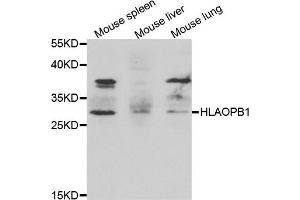 Western blot analysis of extracts of various cell lines, using HLA-DPB1 antibody. (HLA-DPB1 anticorps)