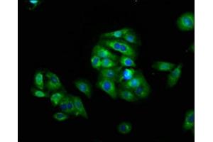 Immunofluorescence staining of HepG2 cells with ABIN7158613 at 1:66, counter-stained with DAPI. (LAG3 anticorps  (AA 29-450))