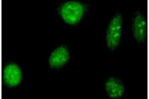 Immunofluorescence of purified MaxPab antibody to TAF12 on HeLa cell. (TAF12 anticorps  (AA 1-161))
