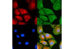 ABIN6258236 and ABIN6274733 staining  cells(UV treatment) by IF/ICC. (MRPL18 anticorps  (Internal Region))