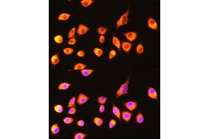 Immunofluorescence analysis of L929 cells using GBP2 Rabbit pAb  at dilution of 1:100 (40x lens). (GBP2 anticorps  (AA 410-520))
