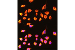 Immunofluorescence analysis of L929 cells using GBP2 Rabbit pAb  at dilution of 1:100 (40x lens).