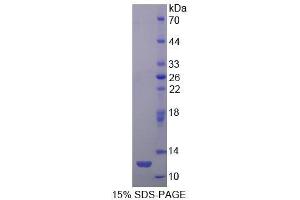 SDS-PAGE (SDS) image for Cholesteryl Ester Transfer Protein (CETP) (AA 353-443) protein (His tag) (ABIN1525386) (CETP Protein (AA 353-443) (His tag))
