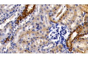 Detection of CK18 in Rat Kidney Tissue using Polyclonal Antibody to Cytokeratin 18 (CK18)