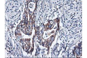 Image no. 2 for anti-Histidyl-tRNA Synthetase 2, Mitochondrial (Putative) (HARS2) antibody (ABIN1498585) (HARS2 anticorps)