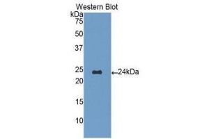 Western Blotting (WB) image for anti-Orosomucoid 1 (ORM1) (AA 19-201) antibody (ABIN1077768) (ORM1 anticorps  (AA 19-201))