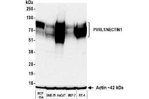 anti-Nectin-1 (NECTIN1) (AA 225-275) antibody