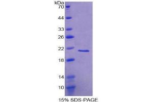 SDS-PAGE (SDS) image for Visinin-Like 1 (VSNL1) (AA 39-184) protein (His tag) (ABIN1878685)