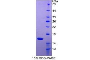 SDS-PAGE of Protein Standard from the Kit (Highly purified E. (GDF2 Kit CLIA)