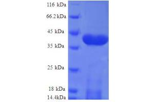NADH Dehydrogenase (Ubiquinone) Fe-S Protein 5, 15kDa (NADH-Coenzyme Q Reductase) (NDUFS5) (AA 2-106), (full length) protein (GST tag) (NDUFS5 Protein (AA 2-106, full length) (GST tag))