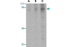 Western blot analysis of BRSK2 in human brain tissue lysate with BRSK2 polyclonal antibody  at (A) 0. (BRSK2 anticorps  (C-Term))