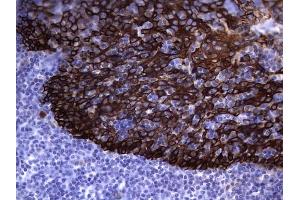 Immunohistochemistry (IHC) image for anti-Keratin Acidic (AE1) antibody (ABIN2715666)