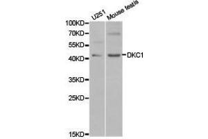 Western Blotting (WB) image for anti-Dyskeratosis Congenita 1, Dyskerin (DKC1) antibody (ABIN1872276) (DKC1 anticorps)