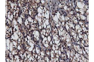 Image no. 4 for anti-V-Akt Murine Thymoma Viral Oncogene Homolog 1 (AKT1) antibody (ABIN1496557) (AKT1 anticorps)