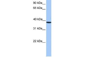 WB Suggested Anti-CSNK2A2 Antibody Titration: 0. (CSNK2A2 anticorps  (C-Term))