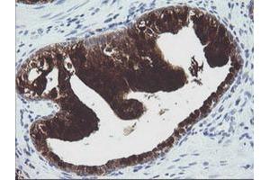 Image no. 7 for anti-Cytidine Monophosphate (UMP-CMP) Kinase 1, Cytosolic (CMPK1) antibody (ABIN1497542)