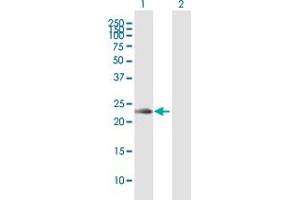 Western Blot analysis of KLRC2 expression in transfected 293T cell line by KLRC2 MaxPab polyclonal antibody.