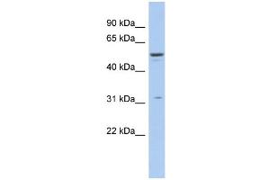WB Suggested Anti-TRIM14 Antibody Titration:  0. (TRIM14 anticorps  (Middle Region))