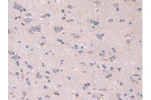 IHC-P analysis of Human Brain Tissue, with DAB staining. (S100A5 anticorps  (AA 1-92))
