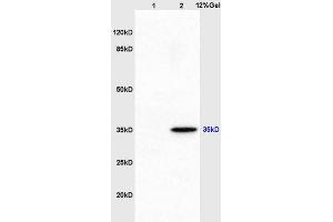 Lane 1: mouse embryo lysates Lane 2: mouse brain lysates probed with Anti AIMP2 Polyclonal Antibody, Unconjugated (ABIN741300) at 1:200 in 4 °C.