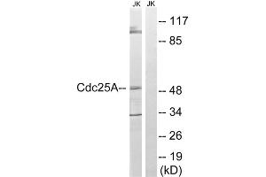 Western blot analysis of extracts from Jurkat cells, using CDC25A (epitope around residue 178) antibody. (CDC25A anticorps  (Ser178))