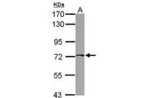 Image no. 1 for anti-ATP-Binding Cassette, Sub-Family D (Ald), Member 4 (ABCD4) (AA 38-296) antibody (ABIN1496386)
