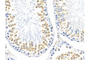ABIN6263429 and ABIN6266804 at 1/100 staining Rat testis tissue by IHC-P. (MUC13 anticorps  (C-Term))