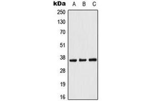 Western blot analysis of ACOT8 expression in Raji (A), NIH3T3 (B), PC12 (C) whole cell lysates. (ACOT8 anticorps  (Center))