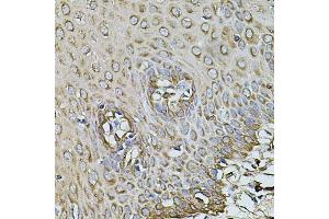 Immunohistochemistry of paraffin-embedded human esophagus using CPOX antibody (ABIN5971997) at dilution of 1/100 (40x lens). (CPOX anticorps)