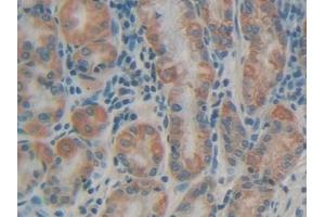 Detection of MUC5AC in Human Stomach Tissue using Polyclonal Antibody to Mucin 5 Subtype AC (MUC5AC) (MUC5AC anticorps)