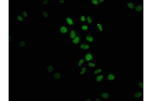Immunofluorescence staining of Hela cells with ABIN7127502 at 1:23, counter-stained with DAPI.