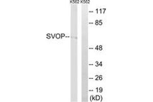 Western blot analysis of extracts from K562 cells, using SVOP Antibody. (SVOP anticorps  (AA 271-320))