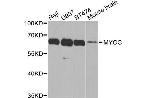 Western blot analysis of extracts of various cell lines, using MYOC antibody (ABIN1873807) at 1:1000 dilution.