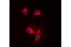 Immunofluorescent analysis of CDC25A staining in MCF7 cells.