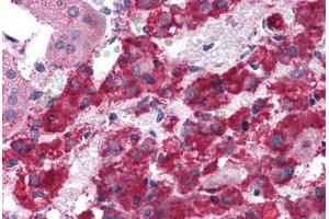 Human Adrenal: Formalin-Fixed, Paraffin-Embedded (FFPE) (LYRM2 anticorps  (C-Term))