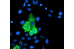 Anti-ALOX15 mouse monoclonal antibody (ABIN2455524) immunofluorescent staining of COS7 cells transiently transfected by pCMV6-ENTRY ALOX15 (RC206621). (ALOX15 anticorps)
