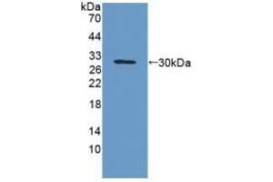Detection of Recombinant GPA33, Rat using Polyclonal Antibody to Glycoprotein A33 (GPA33) (GPA33 anticorps  (AA 22-235))