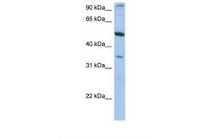 Image no. 1 for anti-Plexin Domain Containing 1 (PLXDC1) (AA 74-123) antibody (ABIN6749741) (PLXDC1 anticorps  (AA 74-123))
