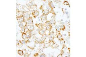 Immunohistochemistry (IHC) image for anti-Eukaryotic Translation Initiation Factor 4H (EIF4H) (AA 198-248) antibody (ABIN7453834)