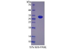 SDS-PAGE analysis of Rat GFM2 Protein. (GFM2 Protéine)