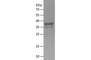 Western Blotting (WB) image for Pleckstrin Homology Domain Containing, Family F (With FYVE Domain) Member 1 (PLEKHF1) (AA 138-279) protein (His-IF2DI Tag) (ABIN7124487) (PLEKHF1 Protein (AA 138-279) (His-IF2DI Tag))