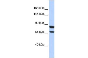 Host:  Rabbit  Target Name:  PGR  Sample Type:  HepG2 Whole cell lysates  Antibody Dilution:  1. (Progesterone Receptor anticorps  (N-Term))