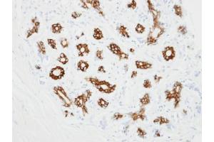 IHC-P Image Immunohistochemical analysis of paraffin-embedded ES2 xenograft, using alpha 2c Adrenergic Receptor, antibody at 1:100 dilution.