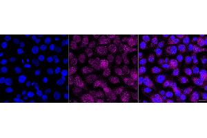 Immunocytochemical staining of HT- cells with Neutrophil cytosolic factor 4 antibody(ABIN7799589), 1:1,000). (Recombinant NCF4 anticorps)